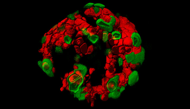 Living pancreatic islets; 2-Photon Microscopy, 63X. Edinburgh Super-Resolution Imaging Consortium, Heriot-Watt University, Edinburgh, Scotland. (Photo by Dr. Rory Duncan/Nikon Small World 2014)