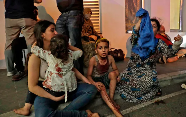 Wounded people wait to received help outside a hospital following an explosion in the Lebanese capital Beirut on August 4, 2020. Two huge explosion rocked the Lebanese capital Beirut, wounding dozens of people, shaking buildings and sending huge plumes of smoke billowing into the sky. Lebanese media carried images of people trapped under rubble, some bloodied, after the massive explosions, the cause of which was not immediately known. (Photo by Ibrahim Amro/AFP Photo)