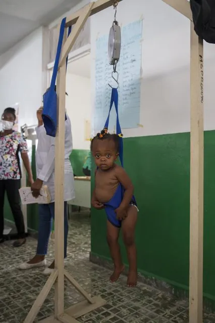 A child eyes the camera as she is weighed at a malnutrition clinic run by UNICEF, in Les Cayes, Haiti, Wednesday, May 26, 2021. (Photo by Joseph Odelyn/AP Photo)