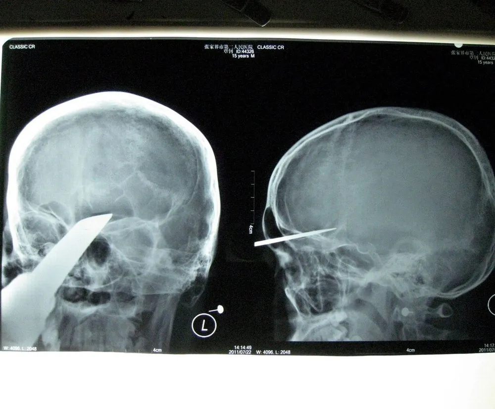 Simply Some Photos: MRI Scans
