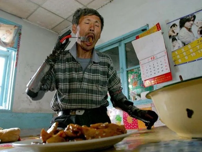  Farmer Builds Own Bionic Arms