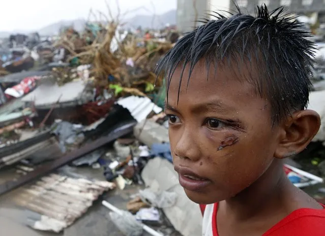 A boy who was wounded by flying debris due to Super Typhoon Haiyan stays at the ruins of his family's house in Tacloban city November 10, 2013. (Photo by Erik De Castro/Reuters)
