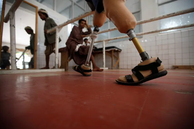 A man with amputated legs tests artificial legs at a prosthetic limbs centre in Sanaa, Yemen, May 14, 2016. (Photo by Mohamed al-Sayaghi/Reuters)
