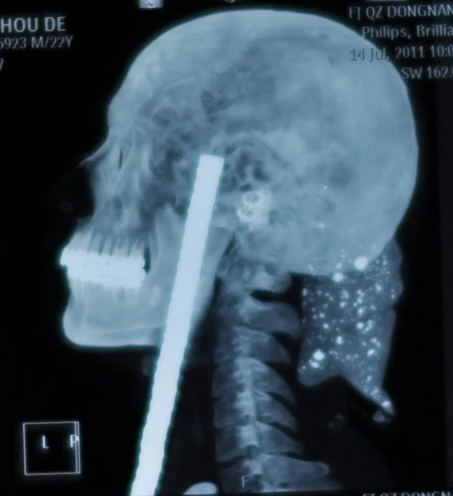 Simply Some Photos: MRI Scans