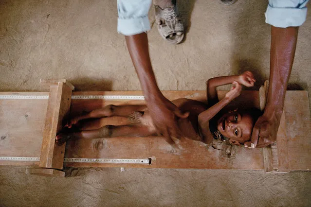 North Kenya, Liboi.  Hospital in Somali refugee camp in July 1992. (Jean-Claude Coutausse)