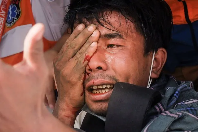 A wounded man injured in his eye after being hit with a slingshot fired by security forces reacts as he is treated by a medical team following a demonstration against the military coup in Mandalay on February 20, 2021. (Photo by AFP Photo/Stringer)