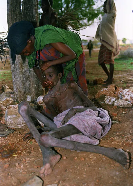 A dying Somali is force-fed by an unidentified local volunteer worker, outside the hospital in Baidoa on Saturday, September 29, 1992. Having eaten, the boy vomited his food, laid his head on the ground and died. The death rate in Baidoa is rising due to deteriorating security and an upsurge in clan warfare which are preventing enough food from being delivered by road. (Photo by Hassan Amini/AP Photo)