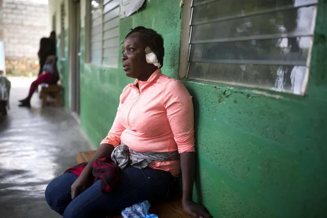Shelda Similien, who ran out of her before it collapsed when a magnitude 5.9 earthquake hit the night before, waits to be treated at a local hospital in Gros Morne, Haiti, Sunday, October 7, 2018. Similien's five year-old son died when he became buried by the rubble of the collapsed home. (Photo by Dieu Nalio Chery/AP Photo)