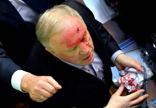 A deputy of the pro-Russian majority bleeds following an argument with a pro-EU opposition MP during a parliament session to debate the 2014 state budget in Kiev on January 16, 2014. The Ukrainian government approved a programme of cooperation with former Soviet states that have joined the Customs Union, although rapprochement with the Russia-led bloc has fuelled continuing pro-Europe protests in Kiev. (Photo by Sergei Supinsky/AFP Photo)