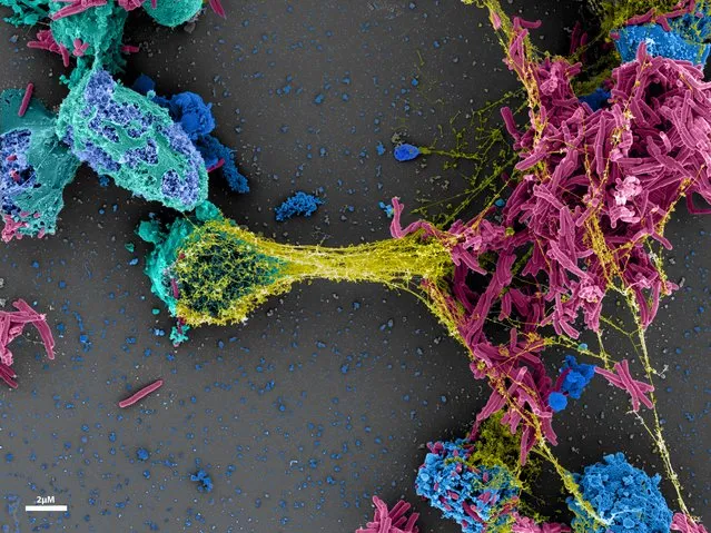 Shortlisted; Spiderman of our body. Missouri, USA. Immune cells communicate with each other to protect our body from invading foreign particles or micro-organisms. Here, neutrophil cells (light blue) release web-like structures (yellow) to defend against tuberculosis bacteria (pink). (Photo by Chanchal Sur Chowdhury/Royal Society of Biology Photography Competition)