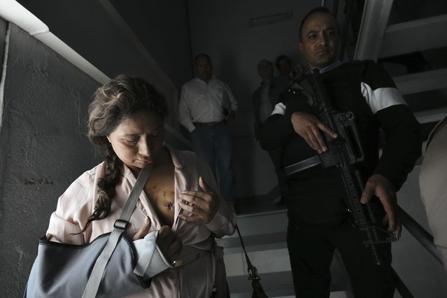 Patricia Barragan, a friend of the family of slain presidential candidate Fernando Villavicencio, shows her stitches after a press conference at which the family announced they will sue the government for not protecting his life while campaigning, in Quito, Ecuador, Friday, August 18, 2023. Ecuadorians will choose a new president Sunday, less than two weeks after the South American country was shaken by the assassination of Villavicencio on Aug. 9. (Photo by Dolores Ochoa/AP Photo)