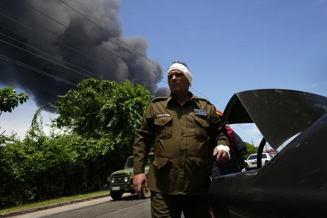 A member of the Interior Ministry injured while trying to help in rescue efforts returns to help, near the Matanzas Supertanker Base, where firefighters work to quell a blaze which began during a thunderstorm the night before, in Matazanas, Cuba, Saturday, August 6, 2022. The fire at an oil storage facility raged uncontrolled Saturday, where four explosions and flames injured nearly 80 people and left over a dozen firefighters missing, Cuban authorities said. (Photo by Ramon Espinosa/AP Photo)