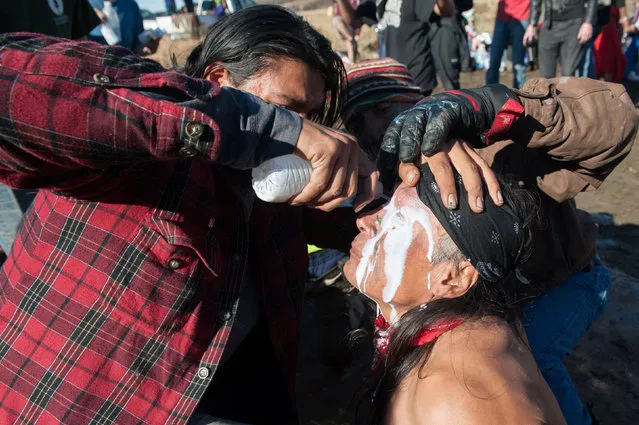 A person pours a pepper spray antidote into a protester's eyes during a protest against the building of a pipeline near the Standing Rock Indian Reservation near Cannonball, North Dakota, U.S. November 2, 2016. (Photo by Stephanie Keith/Reuters)