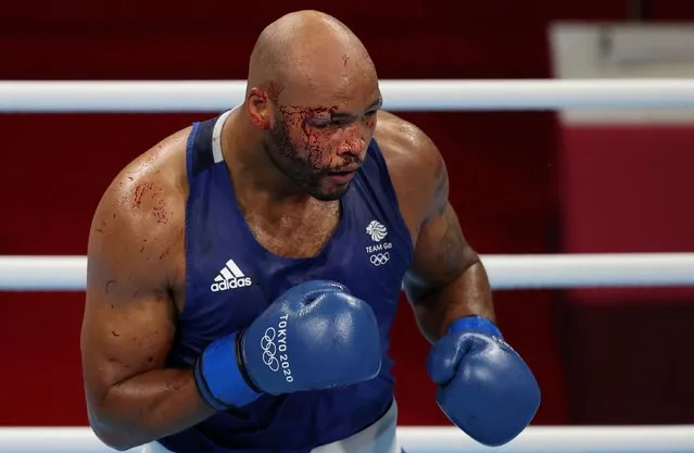 Britain's Frazer Clarke bleeds after an injury as he fights Uzbekistan's Bakhodir Jalolov during their men's super heavy (over 91kg) semi-final boxing match during the Tokyo 2020 Olympic Games at the Kokugikan Arena in Tokyo on August 4, 2021. (Photo by Carl Recine/Reuters)