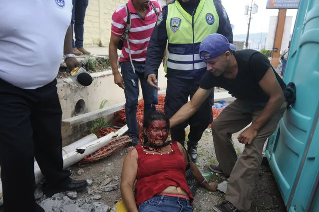 A woman is helped after she was injured when a march belonging to the National Front for Popular Resistance (FNRP) that was protesting against recent government corruption scandals and also to mark the 6th anniversary of the 2008 military overthrow of President Juan Manuel Zelaya, clashed with another march that was supporting the current President Juan Orlando Hernandez in Tegucigalpa, Honduras, Sunday, June 28, 2015. (Photo by Fernando Antonio/AP Photo)