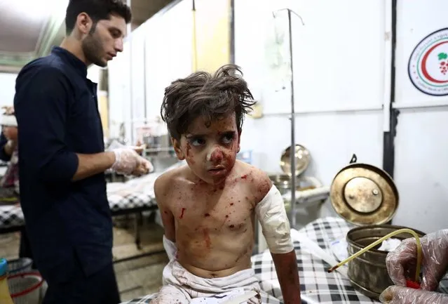 An injured Syrian child receives treatment at a makeshift hospital following a reported air stike on the rebel-held town of Douma, east of the capital Damascus, on August 23, 2016. (Photo by Abd Doumany/AFP Photo)