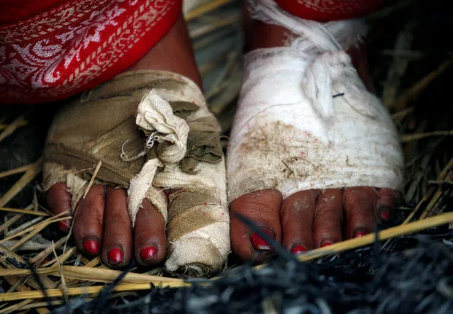 The feet of a devotee wrapped with a bandage are pictured during the Swasthani Bratakatha festival in Panauti, near Kathmandu, Nepal January 31, 2017. (Photo by Navesh Chitrakar/Reuters)