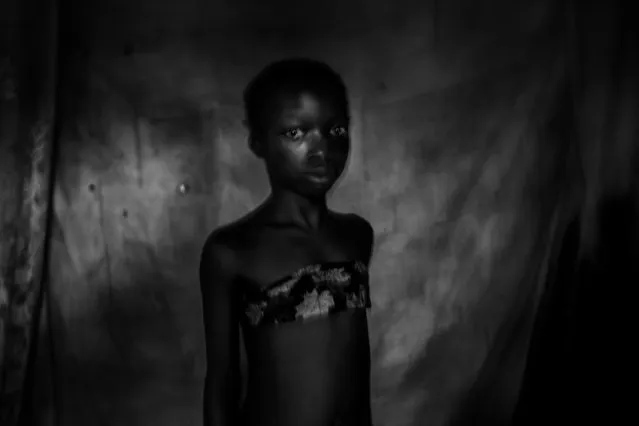Suzanne, 11 years old. two months before that image was taken, she experienced breast ironing until her breasts were totally gone. November 2016, East Cameroon. (Photo by Heba Khamis/World Press Photo)