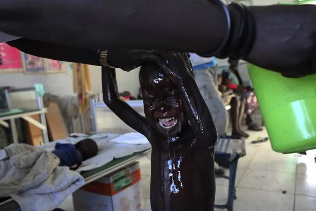 A malnourished South Sudanese child displaced by the fighting in Malakal, cries as he is washed by a nurse at a feeding centre run by Medicins sans Frontiers (MSF) in Kodok, Fashoda county, in this May 28, 2014 file photo. (Photo by Andreea Campeanu/Reuters)