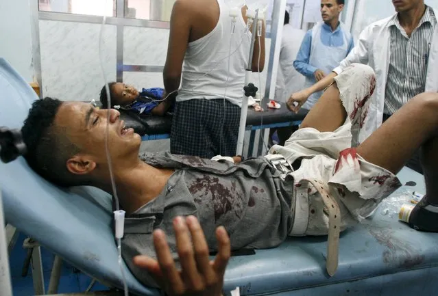 A man lies on a hospital bed after he was injured by a shell that landed in a residential area during fighting between Houthi militants and pro-government militants in Yemen's southwestern city of Taiz September 24, 2015. (Photo by Reuters/Stringer)