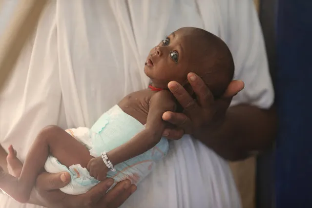 A Mother holds her malnourished baby at the Molai General Hospital Maiduguri, Nigeria November 30, 2016. Photo taken November 30, 2016. (Photo by Afolabai Sotunde/Reuters)