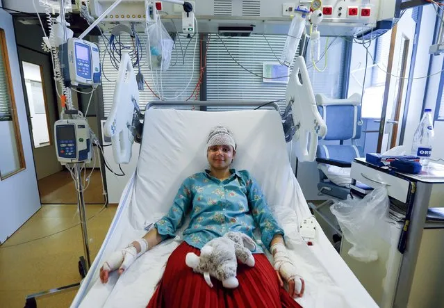 Fanny Clain, a 20-year-old French Mormon sister missionary, gives an interview to Reuters at an hospital, after being injured in the bomb attack at Zaventem International airport while on her way to Cleveland, Ohio, U.S. where she was to complete her missionary assignment, in Antwerp, Belgium March 28, 2016. (Photo by Yves Herman/Reuters)