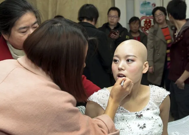 Bride Fan Huixiang (C), a 25-year-old cancer patient, receives make-up on her bed before her wedding at a hospital in Zhengzhou, Henan province, November 17, 2014. (Photo by Reuters/China Daily)