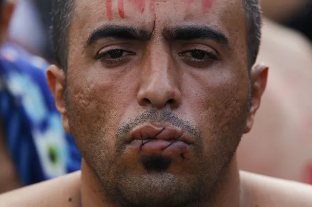 A migrant with his mouth sewn shut in protest sits at the border with Greece near the village of Gevgelija, Macedonia November 23, 2015. (Photo by Ognen Teofilovski/Reuters)