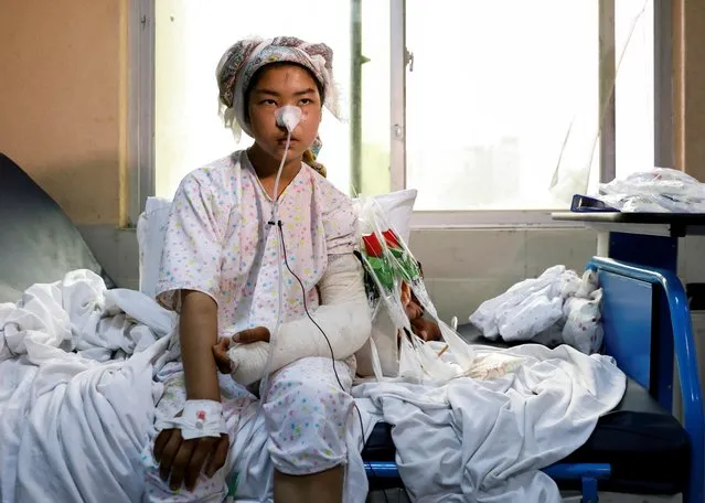 Ruqia Bakhshi, 14, one of the students who was injured in a car bomb blast outside a school on Saturday, receives treatment at a hospital in Kabul, Afghanistan on May 10, 2021. The death toll from a bomb attack outside a school in the Afghan capital Kabul has risen to 68, officials said, with doctors struggling to care for 165 injured victims. (Photo by Reuters/Stringer)