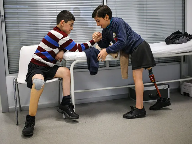 Syrian kids Taha (R) and Ali (L), who lost their legs during regime forces' assaults within civil war in Syria, arm wrestle at Private Kuwait Istanbul Orthotic Prosthetic Center affiliated with Alliance of International Doctors in Edirnekapi, Istanbul, Turkey on March 14, 2019. (Photo by Salih Zeki Fazlioglu/Anadolu Agency/Getty Images)
