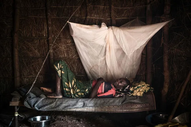 A patient waits for an surgery in the makeshift hospital of the Zapai Internal Displaced People camp near Zemio, on September, 28, 2019. Following violence in 2017, some of Zemio's inhabitants took refuge in Zapai, Democratic Republic of Congo. The two towns, totally isolated, are separated by the Mbomou River, which is taxed by armed groups. (Photo by Florent Vergnes/AFP Photo)