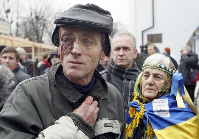 A protestor injured during the night when riot police dispersed protestors in Independence Square, shows his bloodied eye as he gathers with others near the Mikhailovskiy Cathedral in Kiev, Ukraine, 30 November 2013. Riot police dispersed hundreds of protestors, who support the Euro integration of Ukraine, with tear gas and truncheons in a pre-dawn action. (Photo by Sergey Dolzhenko/EPA)