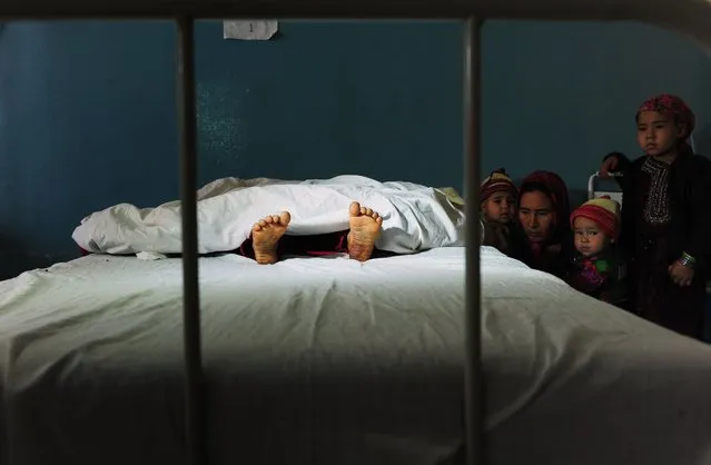 The family of a five year old Afghan girl, that was allegedly raped by a 22 year old man, looks on as she lies in a hospital bed in Kaldar district of Balk Province of Mazar-i-Sharif on November 12, 2012. (Photo by Qais Usyan/AFP Photo)