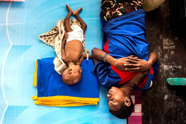 A mother and her three year-old sick child sleep inside a protestant church in Agats, Asmat District, after the government dispatched military and medical personnel to the remote region of Papua to combat malnutrition and measles, Indonesia January 22, 2018 in this photo taken by Antara Foto. (Photo by M. Agung Rajasa/Reuters/Antara Foto)