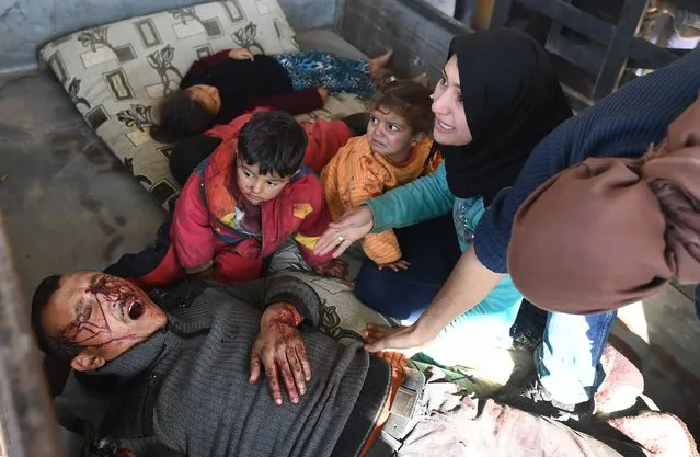 A truck carrying a family, wounded following a Turkish airstrike on a village in the Afrin district, arrives on January 28, 2018, at the Afrin hospital.Turkey launched operation “Olive Branch” on January 20 against the Syrian Kurdish People's Protection Units (YPG) militia in Afrin, supporting Syrian opposition fighters with ground troops and air strikes. (Photo by George Ourfalian/AFP Photo)