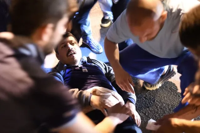 A wounded man is given medical care at the entrance to the Bosphorus bridge in Istanbul on July 16, 2016 following clashes with Turkish military. (Photo by Bulent Kilic/AFP Photo)