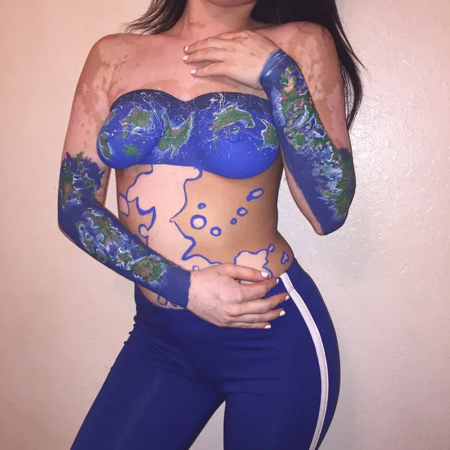 A bullied student with vitiligo is celebrating learning to love her skin by turning it into art  making a world map, flowers and even a Van Gogh painting. Ashley Soto, 21, from Orlando in Florida, USA, has found turning her white patches of skin into art has empowered her and helped her to embrace her vitiligo. She was diagnosed with the condition that affects one percent of the worlds population, at the age of 12 when a porcelain spot appeared on her neck. Within a year, it had spread to 75% of her body in spots and patches. After being asked if she had showered in bleach the teen hid her skin beneath long jumpers and jeans to avoid further ridicule. But now, shes turning her body into art by tracing her vitiligo, making a world map and a beautiful arrangement of flowers to Vincent van Goghs The Starry Night painting. The designs can take up to three hours to paint and outline the melanin-free areas of her body, helping her to appreciate the beauty in her vitiligo. Here are some of the art pieces Ashleys made to celebrate and embrace her vitiligo from a world map to simply tracing her vitiligo and also Van Goghs Starry Night. (Photo by Ashley Soto/Caters News Agency)