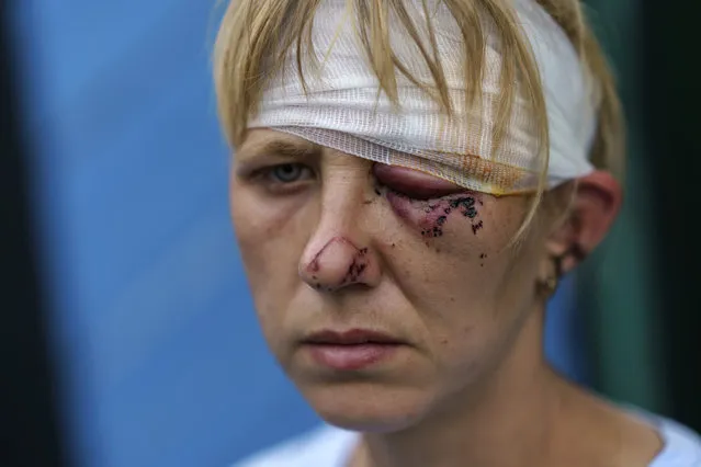 Nelia Fedorova stands outside her home where she was injured in a Russian rocket attack last night, in Kramatorsk, Donetsk region, eastern Ukraine, Saturday, August 13, 2022. The strike killed three people and wounded 13 others, according to the mayor. The attack came less than a day after 11 other rockets were fired at the city. (Photo by David Goldman/AP Photo)