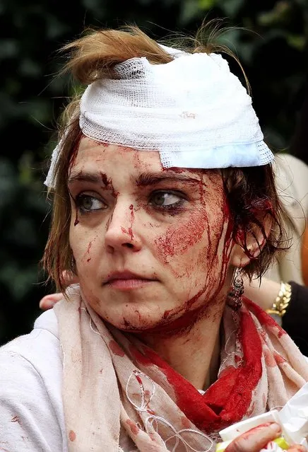 An injured woman gets treatment after an explosion in Prague, on April 29, 2013. Police said a powerful explosion has damaged a building in the center of the Czech capital and they believe some people are buried in the rubble. (Photo by Petr David Josek/Associated Press)