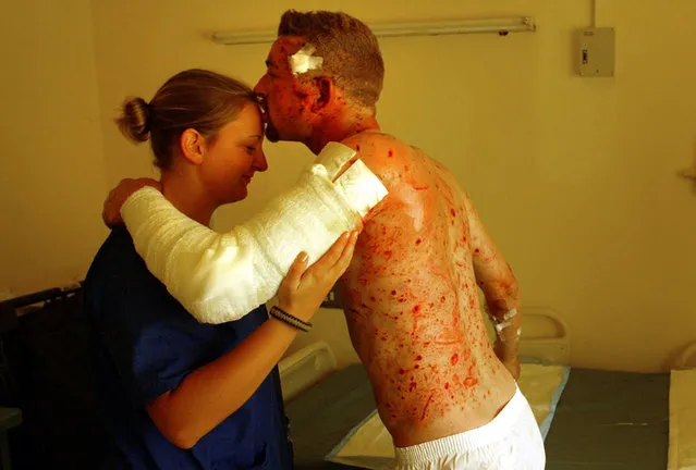 British private contractor Michael Fitzpatrick thanks his U.S. Army nurse Jayme Sells while recovering from a suicide bomb attack in an American military hospital in Baghdad, on October 15, 2004. Fitzpatrick said that he was drinking coffee in the Green Zone Cafe Thursday when a suicide bomber detonated in one of two explosions that killed 6 people and wounded many more. (Photo by John Moore/AP Photo/The Atlantic)