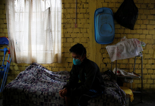 Jose Luis, 20, worked in a print shop before being diagnosed with tuberculosis six months ago, seen at his home in Carabayllo in Lima, Peru July 14, 2016. (Photo by Mariana Bazo/Reuters)