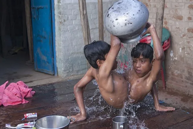 Conjoined Twins Who Are Worshipped In India