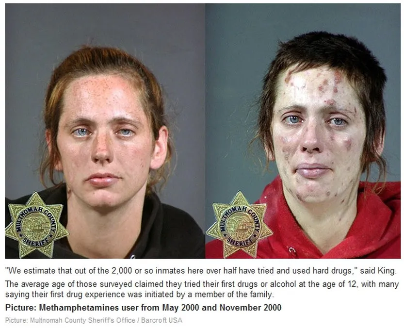 Methamphetamine. Before and After