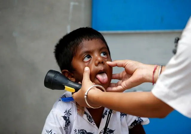 A healthcare worker examines a child during a door-to-door surveillance to safeguard children amidst the spread of the coronavirus disease (COVID-19), at a village on the outskirts of Ahmedabad, India, June 9, 2021. (Photo by Amit Dave/Reuters)