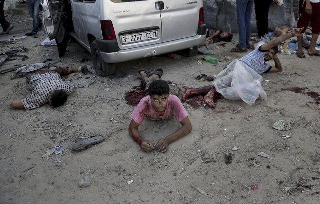 In this July 30, 2014 file photo, an injured Palestinian man lays on the ground among other injured and dead people after an Israeli strike in the Shijaiyah neighborhood of Gaza City. (Photo by Adel Hana/AP Photo)