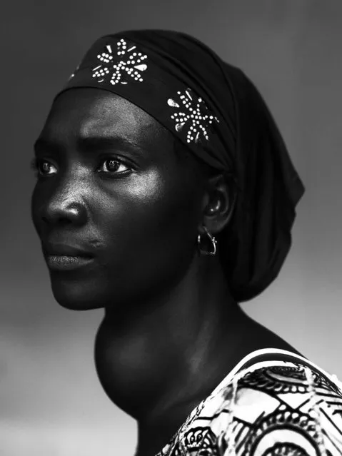 This image by Belgian photographer Stephan Vanfleteren, Panos for Mercy Ships/De Standaard won 1st prize in the People – Staged Portraits Stories category of the 56th World Press Photo Contest with the series “People of Mercy, Guinea”, it was announced by the organizers in Amsterdam, The Netherlands, on 15 February 2013. It shows Makone Soumaoro, 30, in Conakry, Guinea, 17 October 2012, who has a goiter. “I don't have pain, but I am worried that my neck swells that much. I hope it it is not a tumor because I am a housewife and my man and three children need me”. Guinea is one of the least developed countries in the world. More than 60 percent of the population lives on less than one dollar per day. Three quarters of the population is illiterate. Health care is substandard and unaffordable for most people. Some get help with their health problems from NGO Mercy Ships aboard the hospital ship “African Mercy” docked in the capital Conakry. They are treated by volunteer surgeons, doctors and nurses with such health issues as cataracts, teeth problems, and skin diseases to more complex orthopedic or tumor surgeries. (Photo by Stephan Vanfleteren/EPA)
