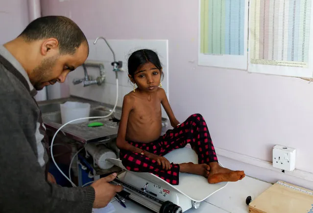 A nurse weighs Afaf Hussein, 10, who is malnourished, at the malnutrition treatment ward of al-Sabeen hospital in Sanaa, Yemen, January 31, 2019. Afaf, who now weighs around 11 kg and is described by her doctor as “skin and bones”, has been left acutely malnourished by a limited diet during her growing years and suffering from hepatitis, likely caused by infected water. She left school two years ago because she got too weak. (Photo by Khaled Abdullah/Reuters)
