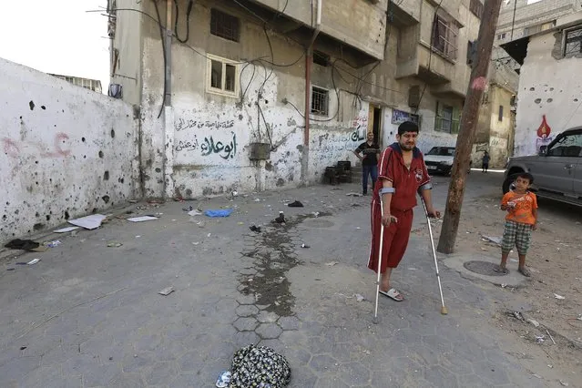 In this Saturday, June 27, 2015 photo, Mohammed al-Selek, 39, shows the site where he was injured by an Israeli mortar strike in front of his family house, during an interview with The Associated Press, in the Shijaiyah neighborhood of Gaza City, northern Gaza Strip. Al-Selek's life changed forever last July 30, when Israeli mortar shells slammed into his home  killing all his three children, his father and six other relatives. (Photo by Adel Hana/AP Photo)