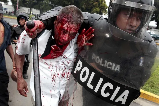 An injured former soldier of the Sandinista Popular Army is detained by police during clashes protesters blocked the entrance to Managua's international airport along to demand that the government of Nicaragua's President Daniel Ortega provide them social benefits as veterans of war on May 31, 2012