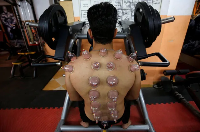 A bodybuilder undergoes Hijama, or cupping therapy, by practitioner Al Sheikh Mohamed El-Sayed inside a gym in Shubra El-Kheima on the outskirts of Cairo, Egypt, August 17, 2016. (Photo by Amr Abdallah Dalsh/Reuters)